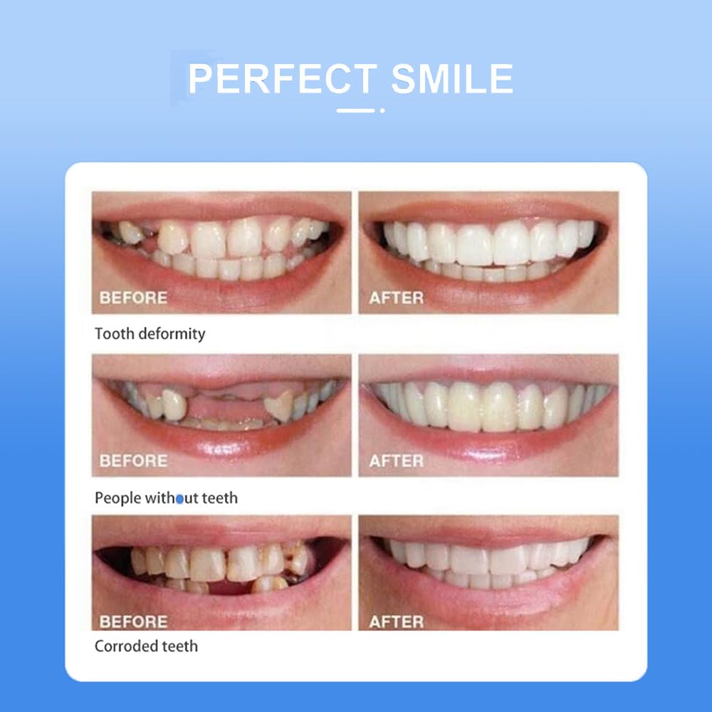 Snap-On smile for Beautiful Smiles Temporary Comfort Fit Whitening Instant Transformation for Men &amp; Women image 2