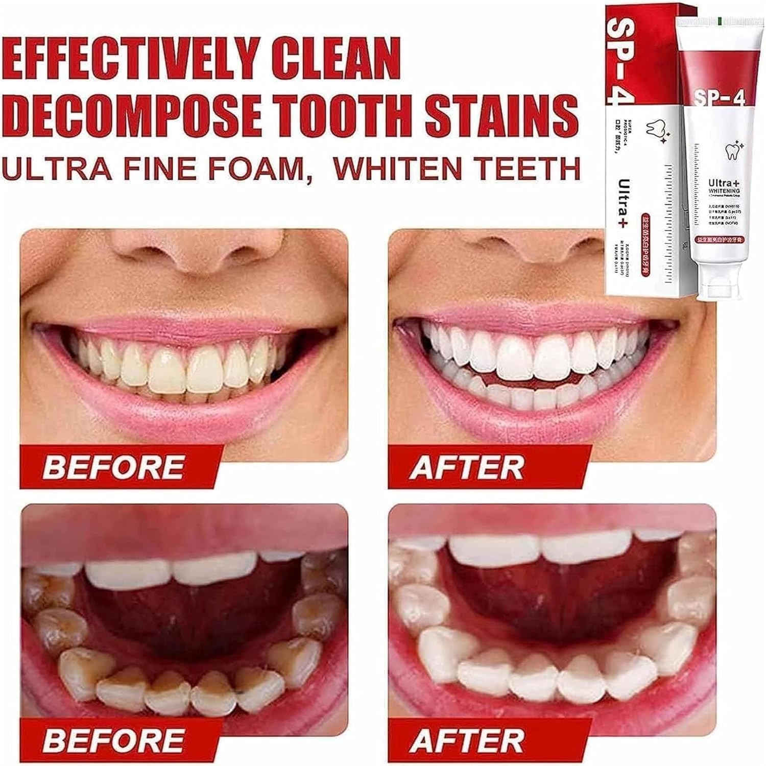 Yayashi Sp-4 Ultra Whitening Toothpaste Probiotic Stain Remover 100ml / Stain Removing Toothpaste, Protects Gums Freshens Breath, for Everyone image 3