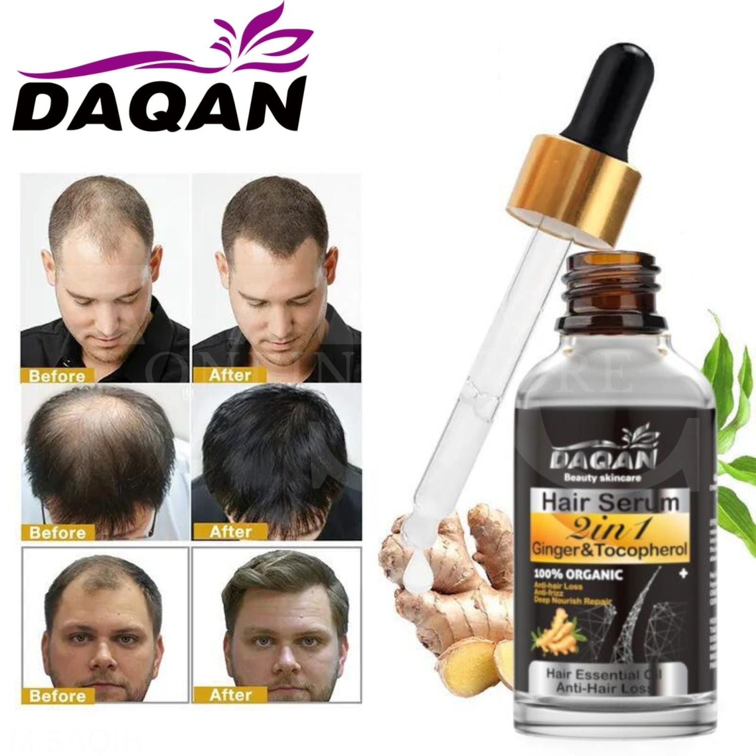 Anti Hair Loss Serum 2 in 1 Natural Hair Fall Serum Ginger and Tocopherol Hair Growth Essence Oil Hair Care Serum | Hair Loss Treatment for Men &amp; Women | image 1