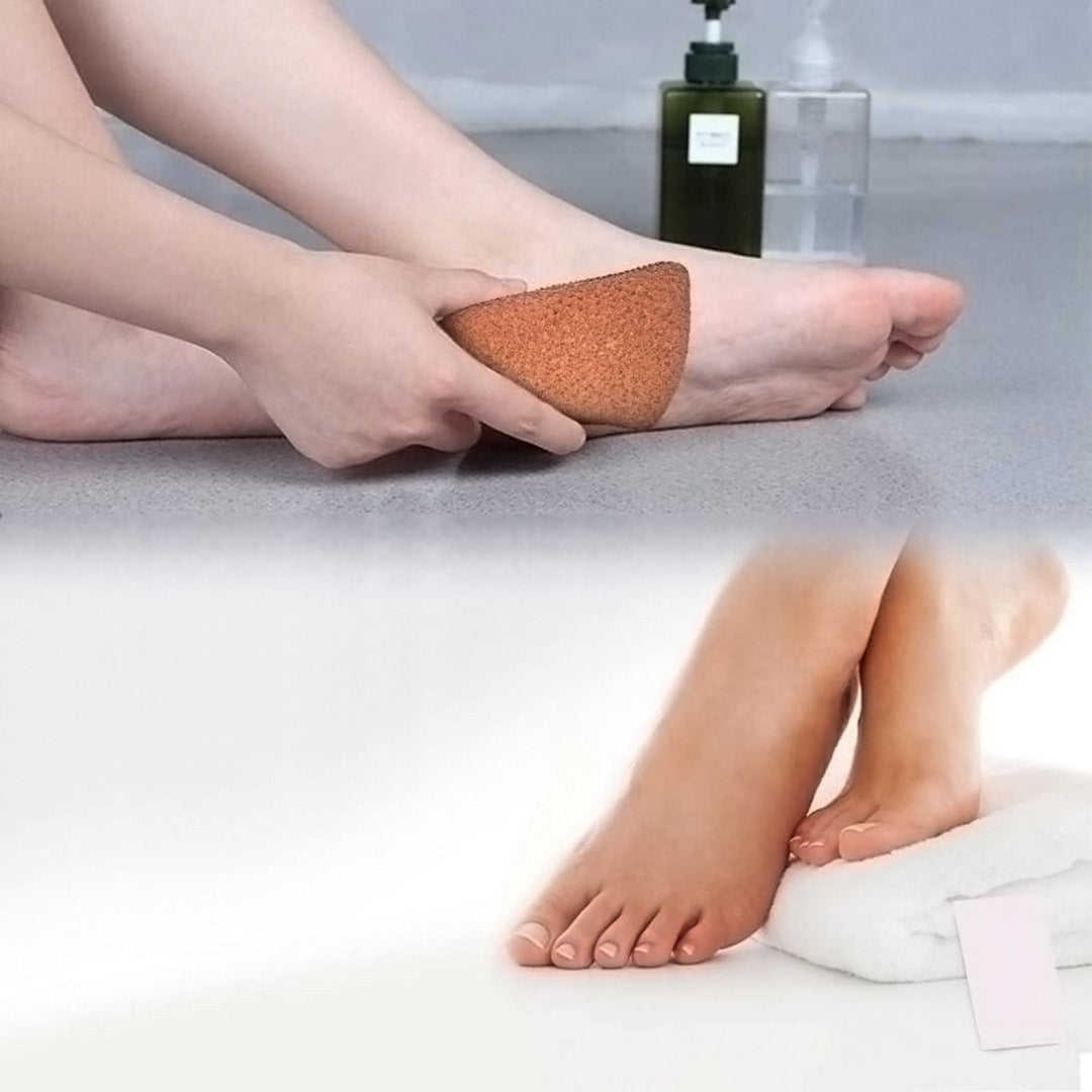 Mud Guru Foot Scrubber, Corn Remover for feet, Dead Skin Remover image 1