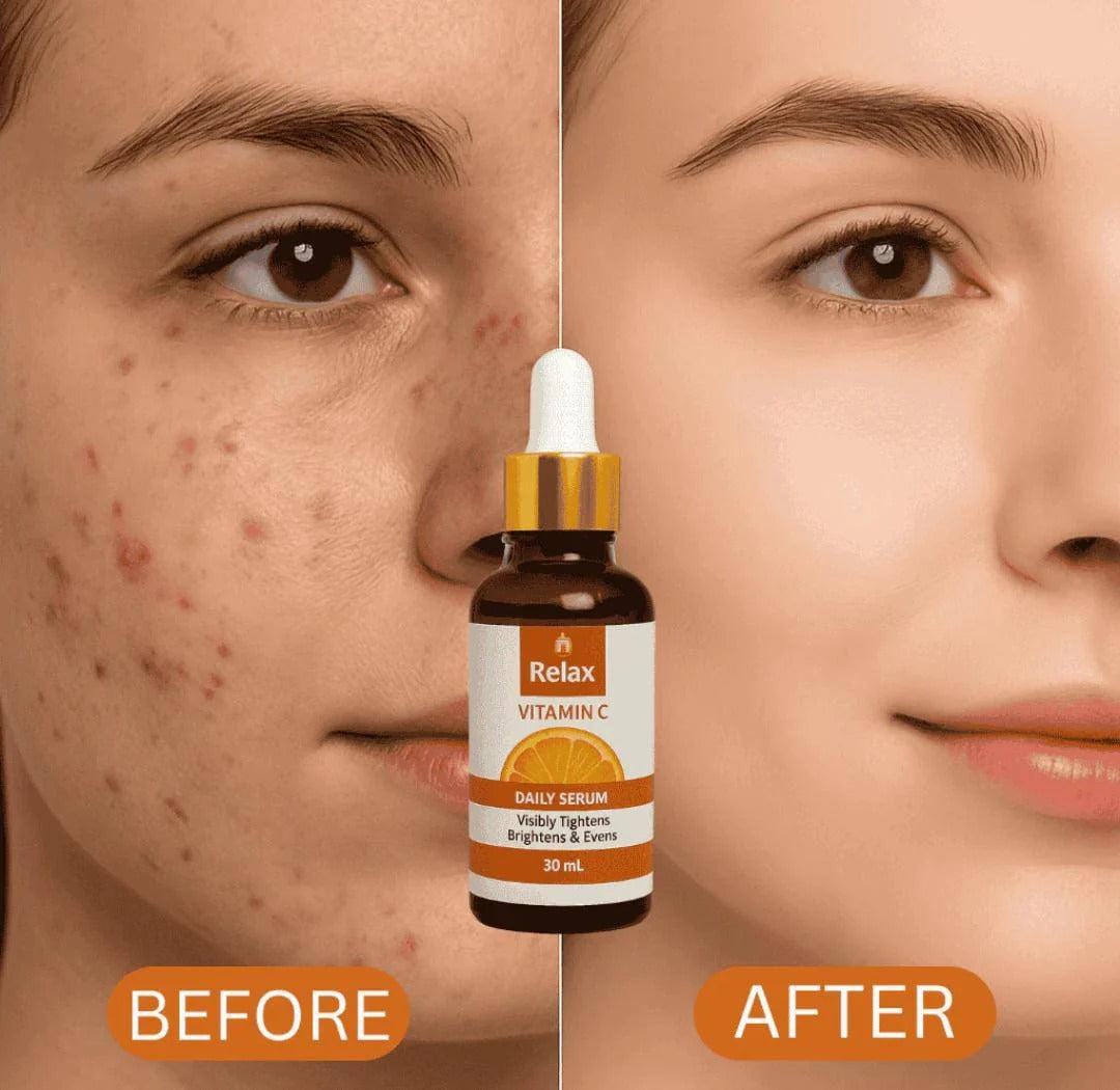 Relax Vitamin C Daily Face Serum – Brightening, Anti-Aging & Hydrating Formula For Healthy Radiant Skin (30ml) image 2