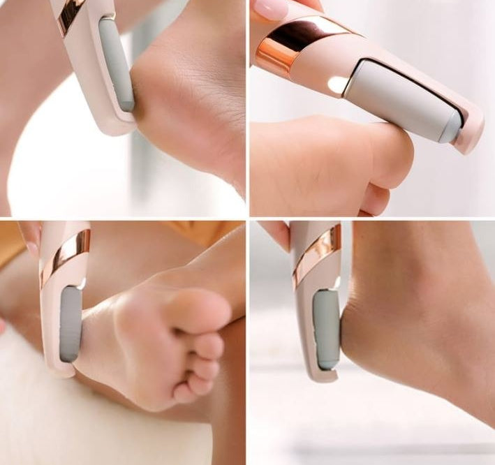 Rechargeable Electric Pedi Foot Filer – Effective Callus Remover for Soft, Smooth Feet image 3