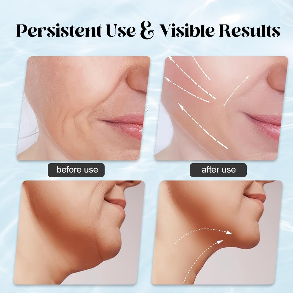 Massager for Face Lifting Facial Massagers EMS Neck Eye Massage Instrument Vibrator Microcurrents Red Light Therapy Anti Wrinkle - Random Color image 0