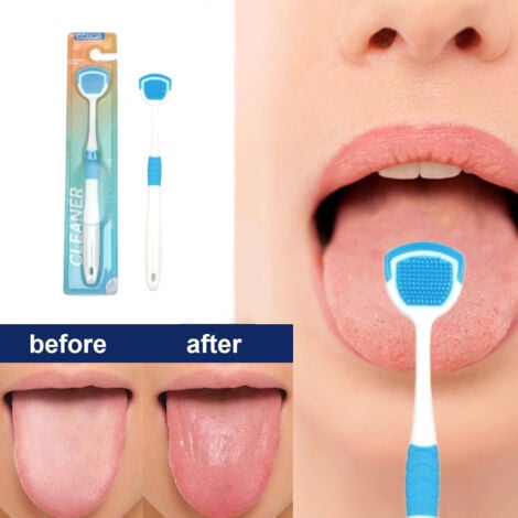 Tongue Cleaner Brush with Soft Silicone Bristles – Oral Hygiene Tool for Fresh Breath &amp; Bacteria Removal -  Tongue Cleaner - Tongue Scraper - Bad Breath Remover - Random Color image 3
