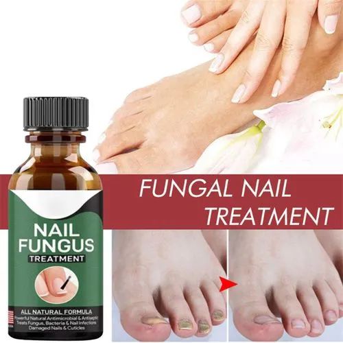 Fast Nail Fungus Treatment Gel – Nail Repair Essence Serum for Healthy, Smooth & Strong Nails image 1