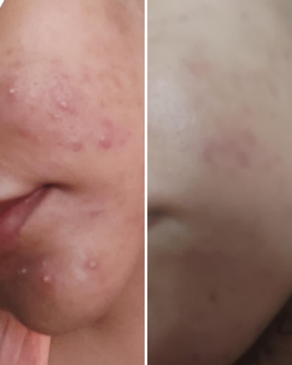Nirvana Botanics Vitamin C + E Serum - Ml 15 | ANTI ACNE &amp; GLOWING SERUM VITAMIN C + E image 4