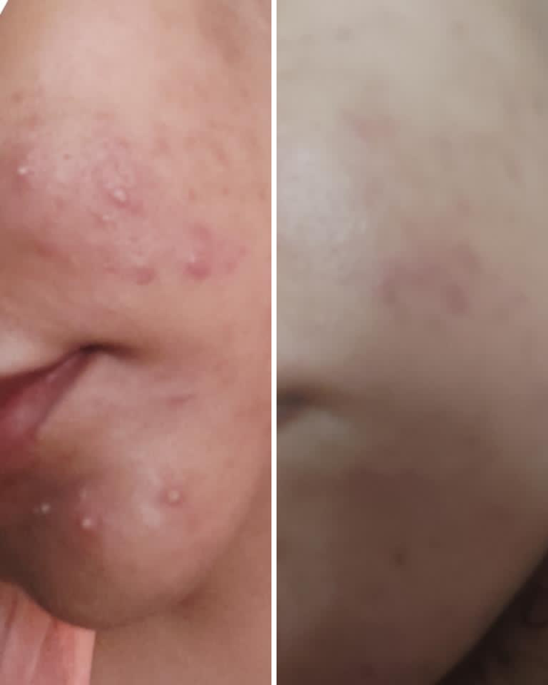 Nirvana Botanics Vitamin C + E Serum - Ml 15 | ANTI ACNE &amp; GLOWING SERUM VITAMIN C + E image 4