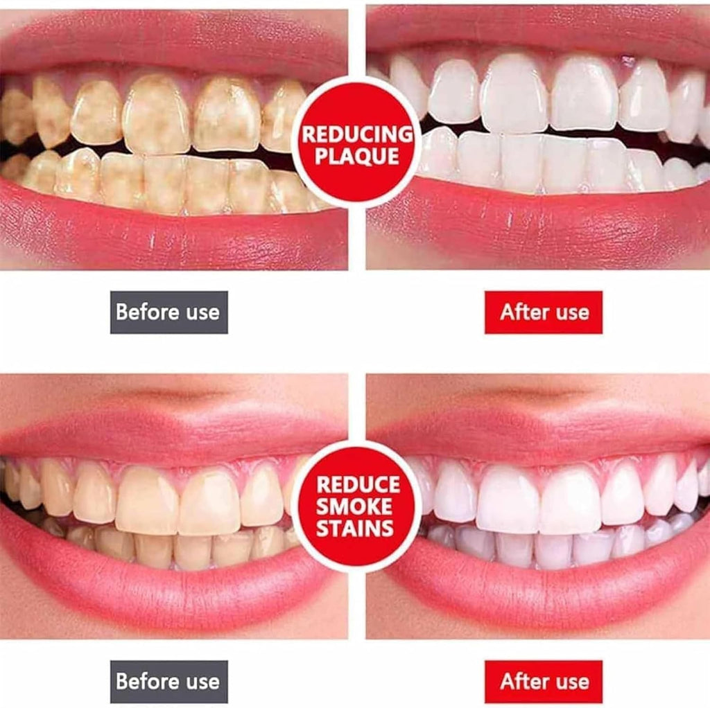 Yayashi Sp-4 Ultra Whitening Toothpaste Probiotic Stain Remover 100ml / Stain Removing Toothpaste, Protects Gums Freshens Breath, for Everyone image 2