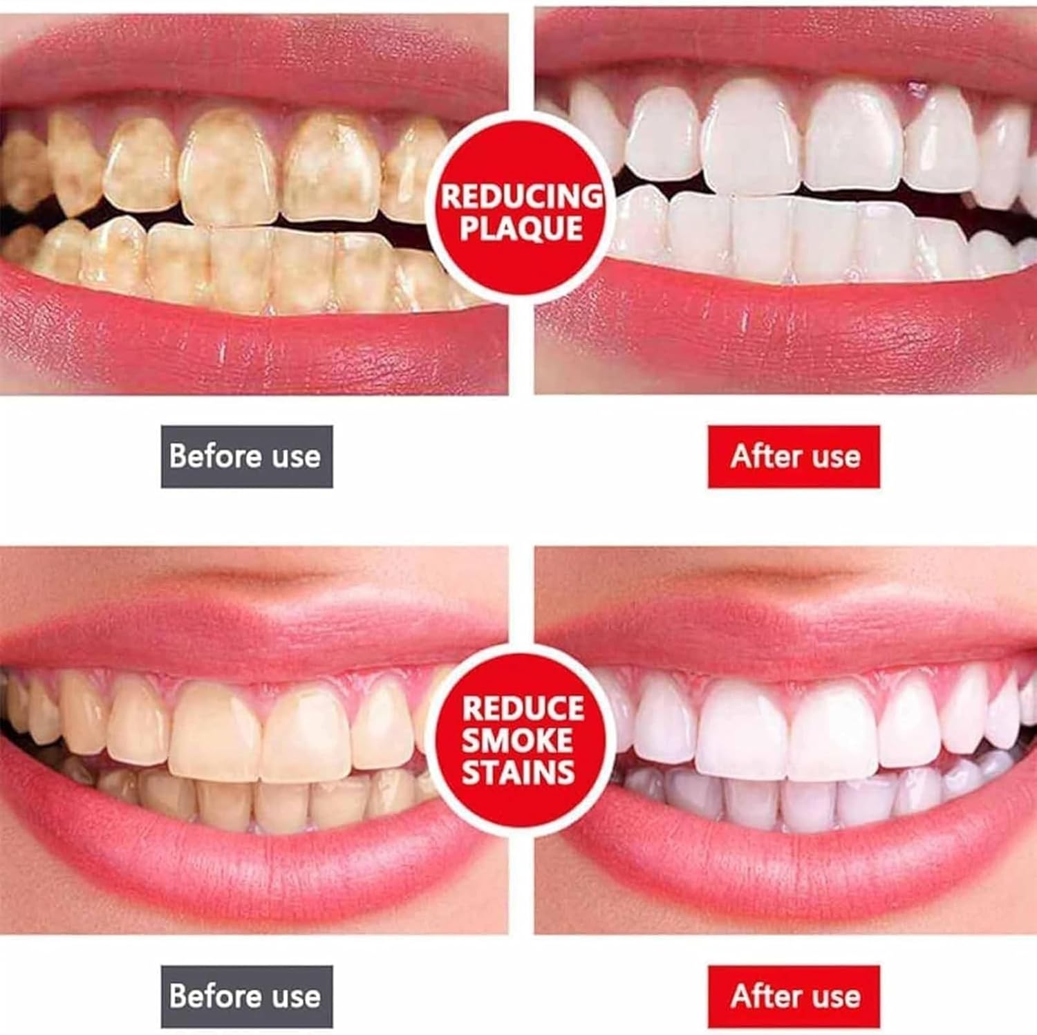 Yayashi Sp-4 Ultra Whitening Toothpaste Probiotic Stain Remover 100ml / Stain Removing Toothpaste, Protects Gums Freshens Breath, for Everyone image 2