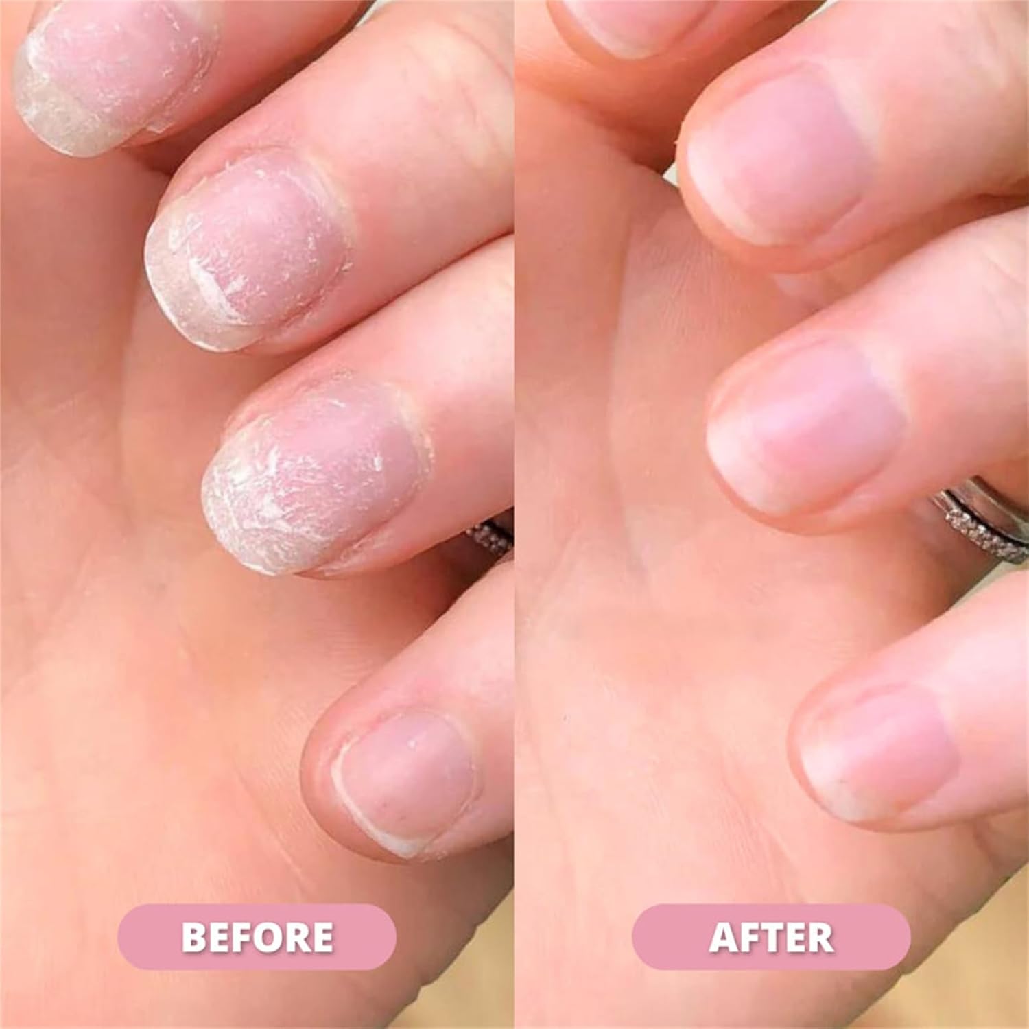 Nail Growth & Cuticle Oil Pen – Radiant Serum Nutrient Pen for Moisturizing, Strengthening & Brightening Nails image 2