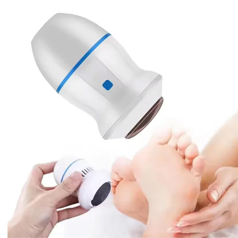 Back Callus Remover with Built-In Vacuum – Electric Foot Grinder for Dead Skin, Cracked Heels &amp; Calluses, Rechargeable Pedicure Tool with Gentle &amp; Powerful Exfoliation image 4