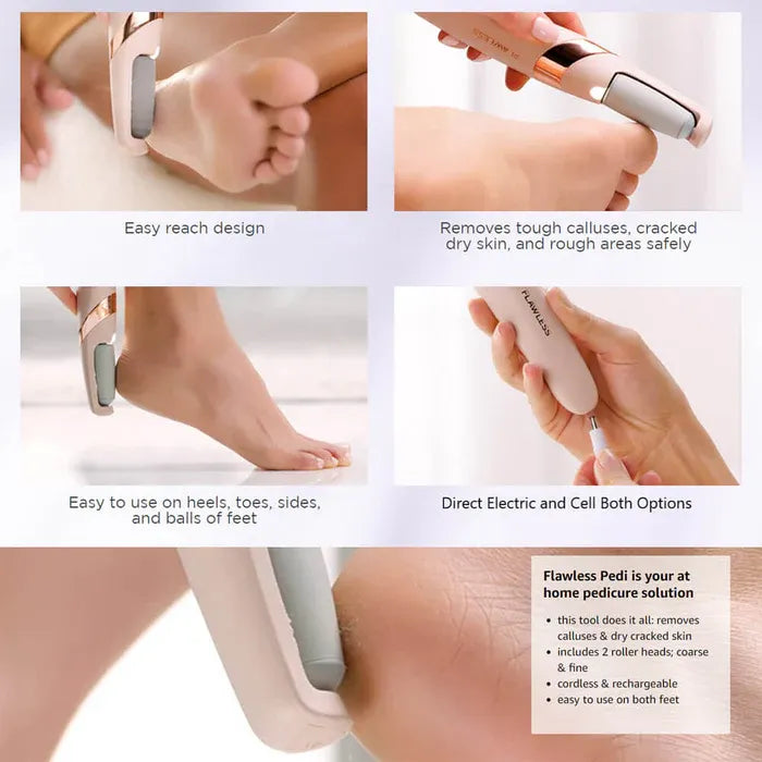 Electric Foot File Grinder – Pedicure Tool for Dead Skin & Callus Removal, Rechargeable Foot Care Machine for Smooth & Soft Feet (Random Color) image 1
