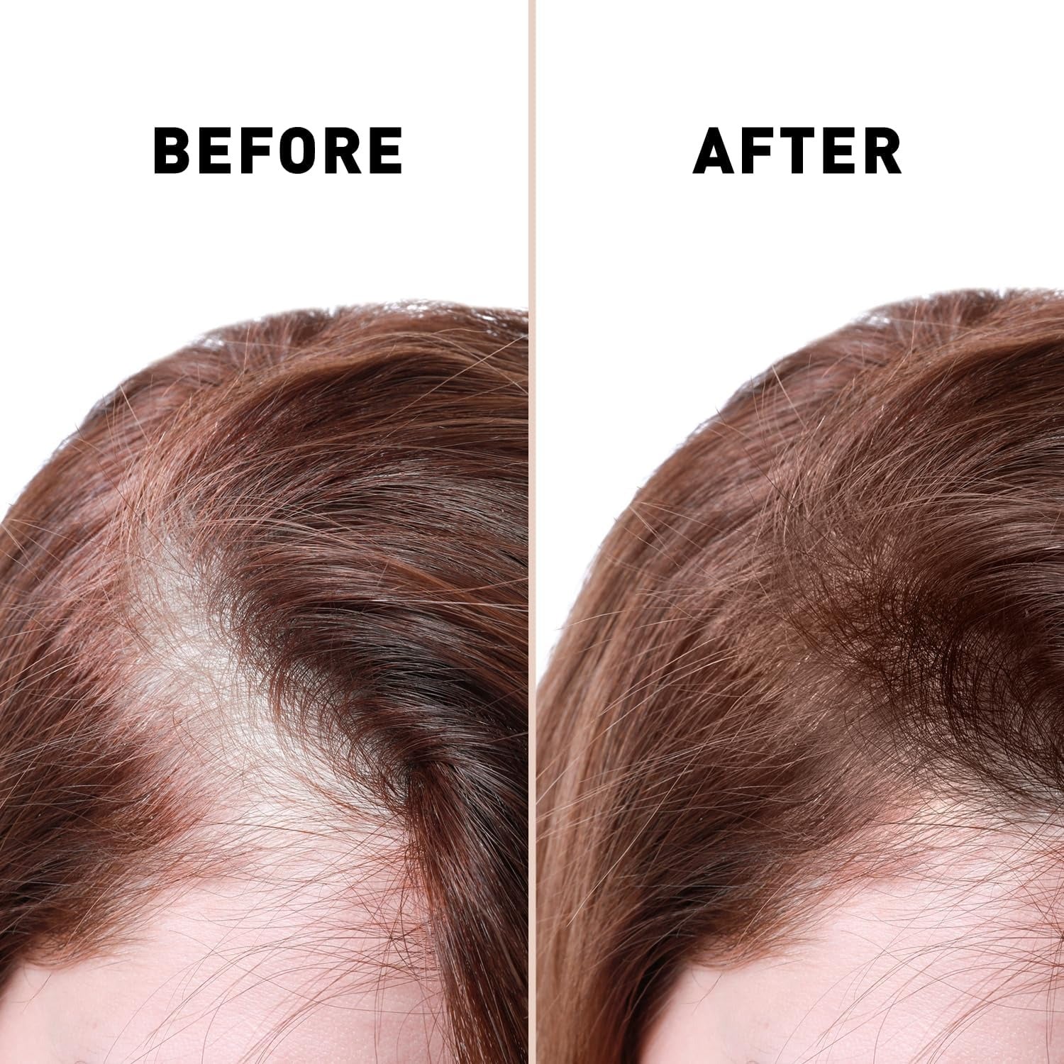 Anti Hair Loss Serum 2 in 1 Natural Hair Fall Serum Ginger and Tocopherol Hair Growth Essence Oil Hair Care Serum | Hair Loss Treatment for Men &amp; Women | image 0