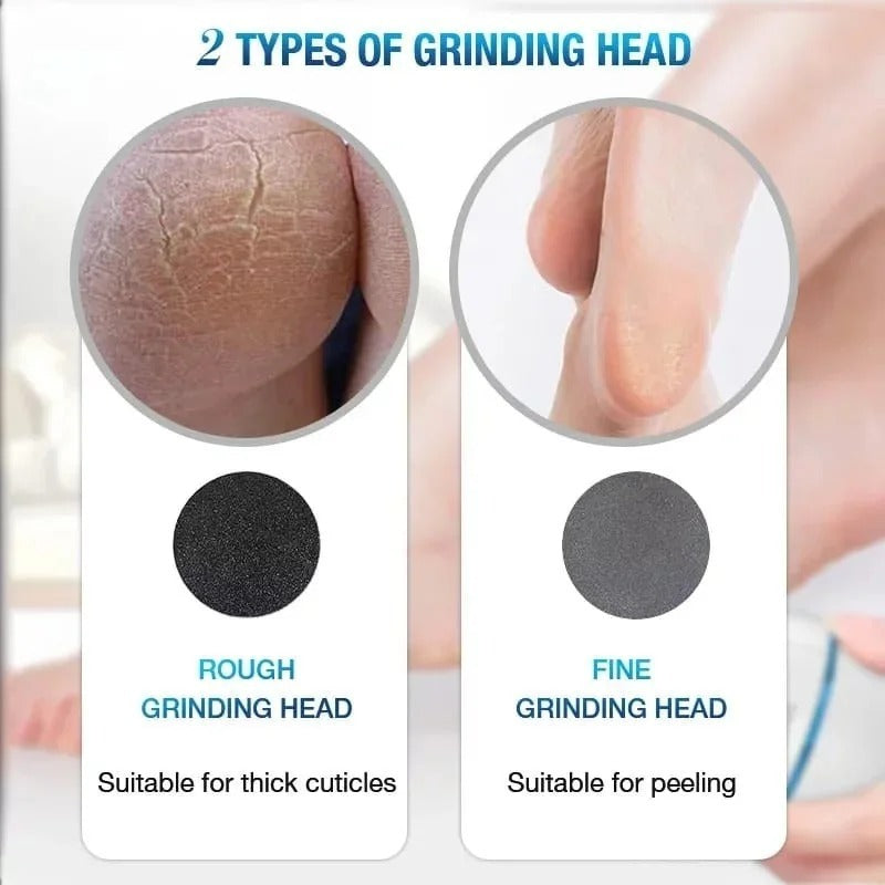 Back Callus Remover with Built-In Vacuum – Electric Foot Grinder for Dead Skin, Cracked Heels &amp; Calluses, Rechargeable Pedicure Tool with Gentle &amp; Powerful Exfoliation image 2